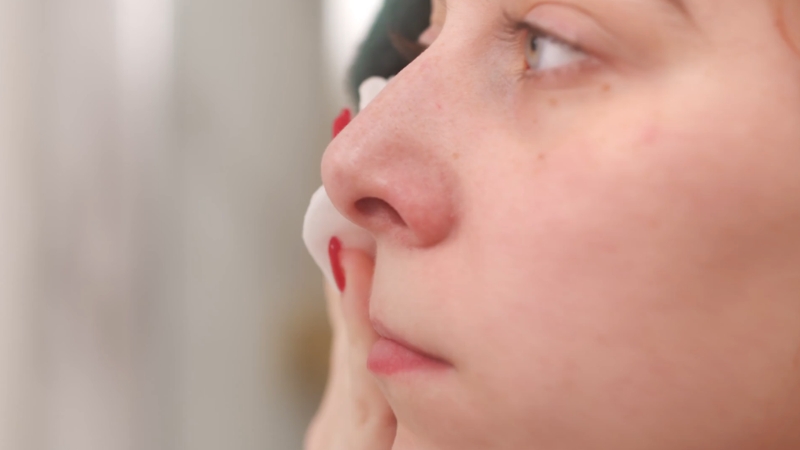 Žena nežno čisti lice pamučnim tuferom